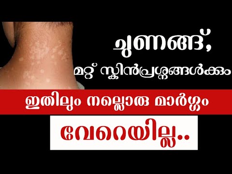 ചുണങ്ങ് പരിഹരിച്ച് ചർമ്മത്തെ സുന്ദരമാക്കാൻ. | Vattachori Maran Malayalam