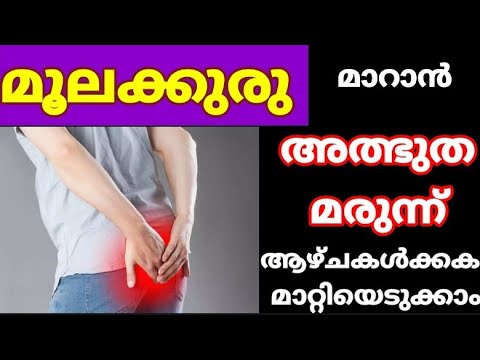 മൂലക്കുരു പരിഹരിക്കാൻ ഇത്തരം കാര്യങ്ങൾ ശ്രദ്ധിച്ചാൽ മതി.. | Piles Treatment At Home Malayalam