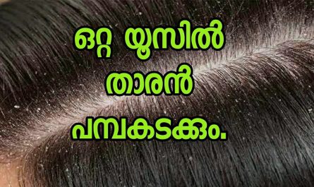 Dandruff treatment at Home