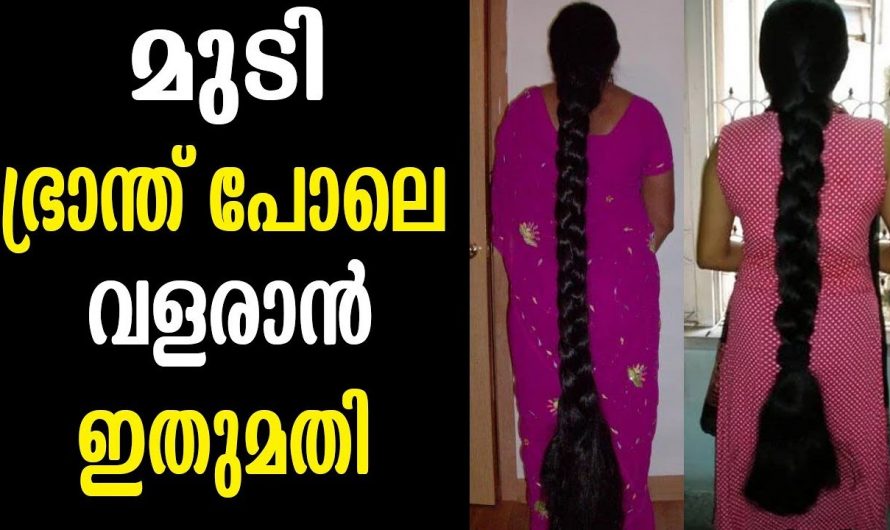 മുടികൊഴിച്ചിൽ തടഞ്ഞു  മുടി വളർച്ച ഇരട്ടിയാക്കുന്നതിന് ഇതാക്കിയതിനാൽ മാർഗ്ഗം. | How to Grow Long and thicken Hair