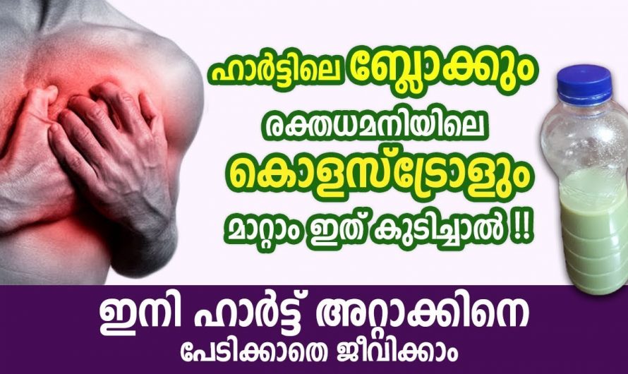 ഹൃദയസമിതമായ അസുഖങ്ങൾക്ക് പരിഹാരം കാണാൻ ഇതാ എളുപ്പം മാർഗം.. | Heart block treatment malayalam