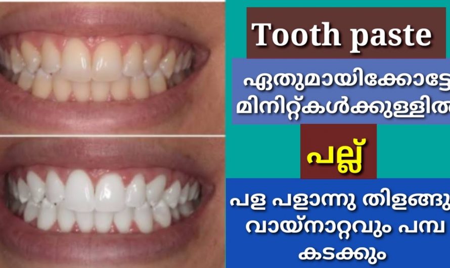 നല്ല ഭംഗിയുള്ള തിളക്കമുള്ള പല്ലുകൾ ലഭിക്കാൻ. | Teeth Whitening Within seconds