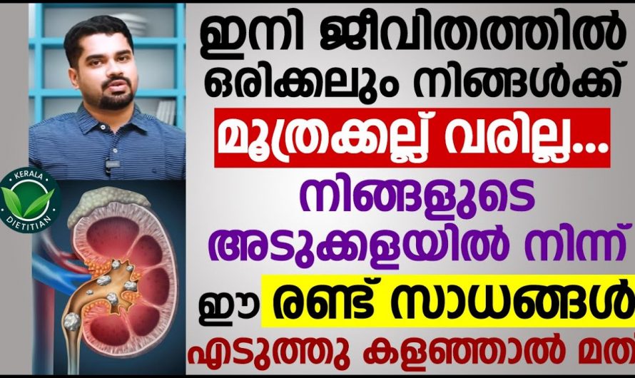 മൂത്രത്തിൽ കല്ല് അറിഞ്ഞിരിക്കേണ്ട കാര്യങ്ങൾ. | urine stone malayalam