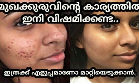 Pimple treatment malayalam