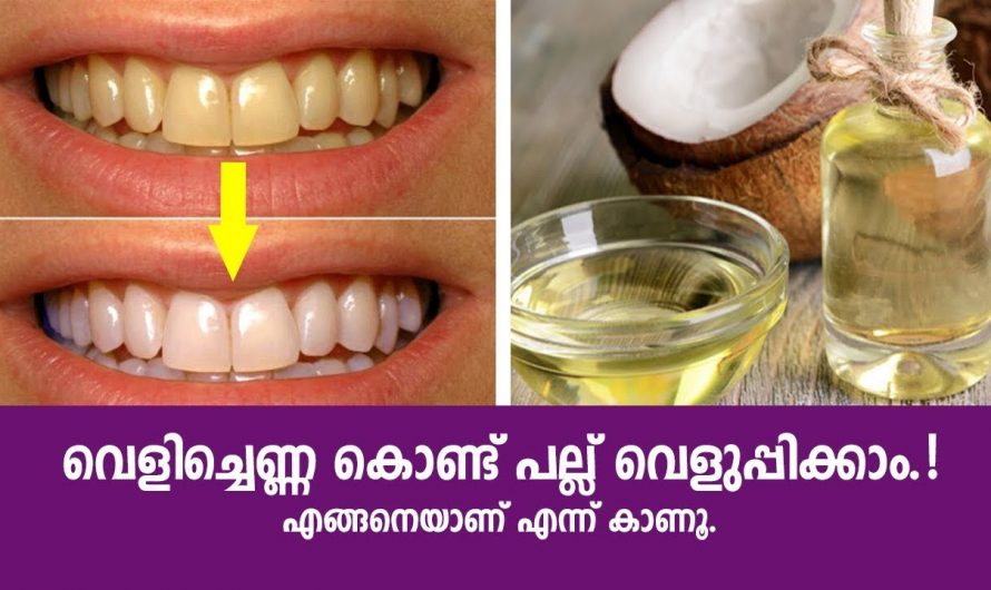 പല്ലുകളെ തിളക്കമുള്ളതാക്കി സംരക്ഷിക്കാൻ. | Home Remedies for Teeth Whitening