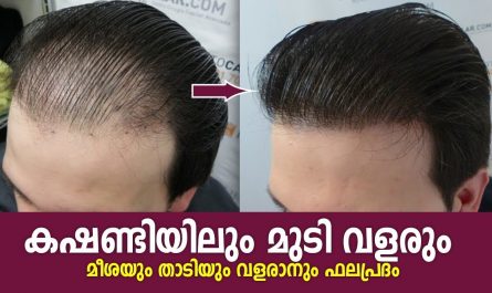 Effective Secret Method To Regrow Hair