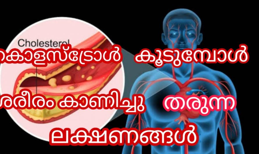 കൊളസ്ട്രോൾ പരിഹരിച്ച് ആരോഗ്യം സംരക്ഷിക്കാൻ  കിടിലൻ വഴി.
