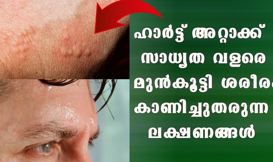 ഹൃദ്രോഗം പേടിക്കേണ്ടതില്ല ശരീരം മുൻകൂട്ടി ചില ലക്ഷണങ്ങൾ കാണിച്ചുതരും