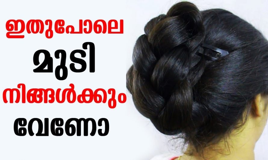 തലമുടിയിലെ താരൻ ഈരെ പേനൻ ശല്യം എന്നിവ പരിഹരിച്ചു മുടിയെ സംരക്ഷിക്കും. | Hair Fall,Dandruff Cure Tips