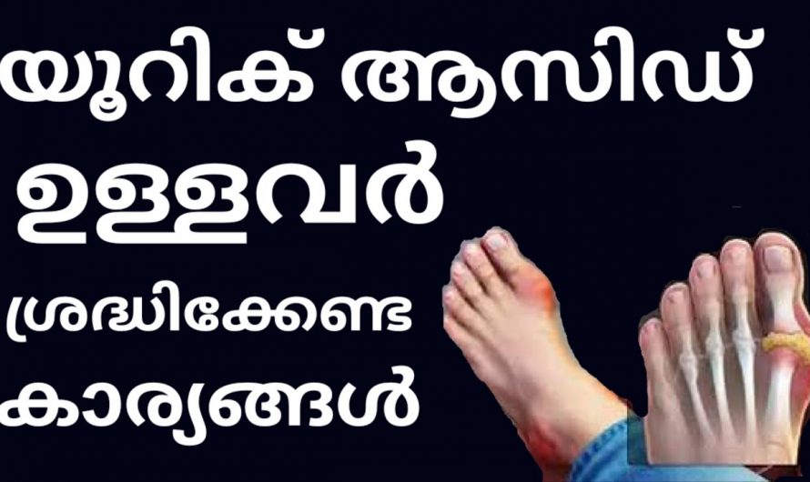 സന്ധികളിലും  പെരുവിരലിലും വേദന ഉണ്ടാകുന്നതിന്റെ പ്രധാനപ്പെട്ട കാരണം ഇത് തന്നെയാണ്. | Uric Acid Treatment Malayalam