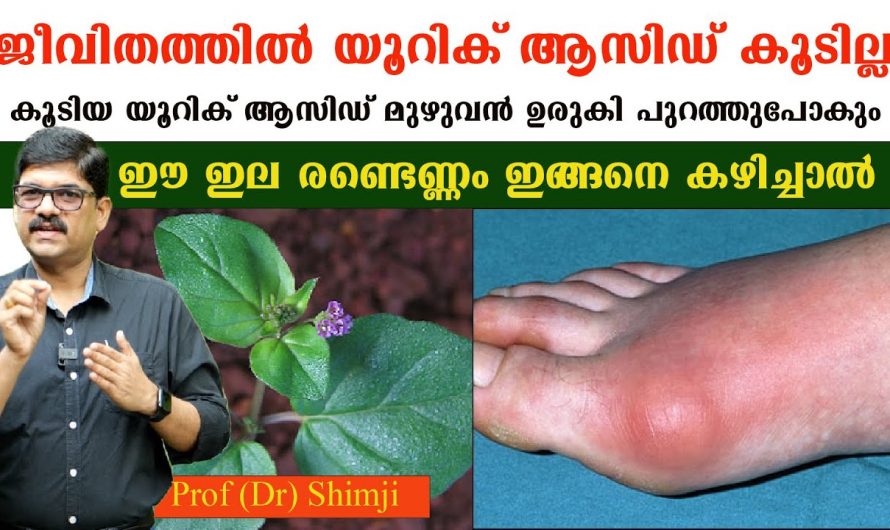 നമ്മുടെ ശരീരത്തിലെ യൂറിക്കാസിഡ് മുഴുവൻ ഉരുകി പുറത്തു പോകുവാൻ ഇങ്ങനെ ചെയ്താൽ മാത്രം മതി