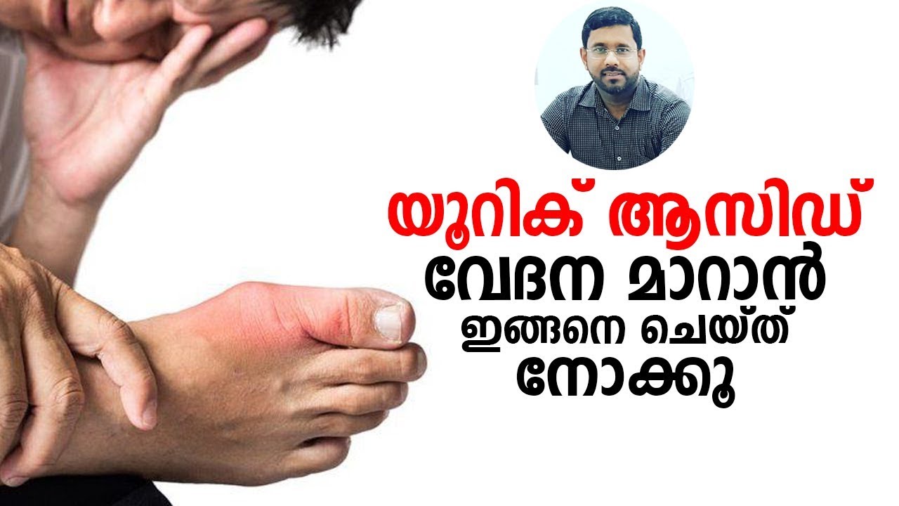 Uric Acid Treatment Malayalam