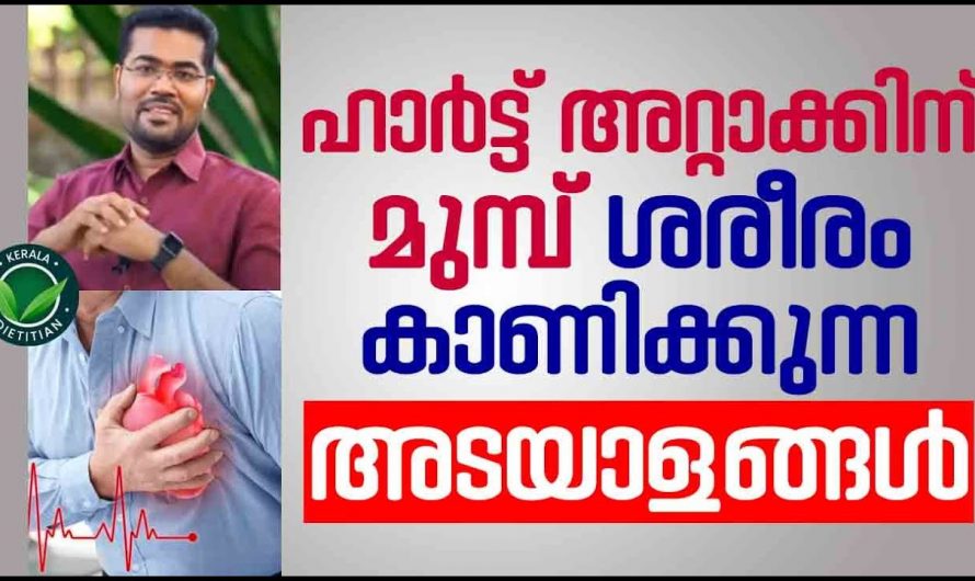 ഉത്തരം ലക്ഷണങ്ങൾ ഹൃദയാഘാതത്തിന്റെ പ്രാരംഭത്തിൽ കാണിക്കും ഒരിക്കലും അവഗണിക്കരുത്. | heart attack malayalam