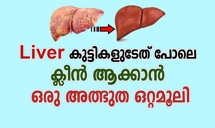 കരൾ ശുദ്ധീകരിച്ച ആരോഗ്യ നിലനിർത്തുന്നതിന് കിടിലൻ വഴി. | Liver Healthy Tips