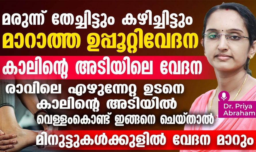 ഉപ്പൂറ്റി വേദന ഉണ്ടാക്കുന്ന കാരണങ്ങളും അതിനുള്ള പ്രതിവിധിയും കുറിച്ച് ഡോക്ടർ വിശദീകരിക്കുന്നു