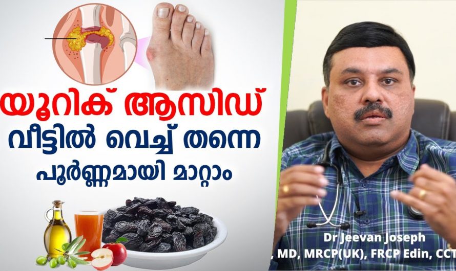 യൂറിക്കാസിഡ് പരിഹരിക്കാൻഇതാ കിടിലൻ വഴി…