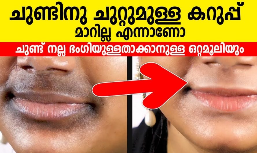 ചുണ്ടിന് ചുറ്റുമുള്ള കറുപ്പ് നിറം അകറ്റുവാനായിട്ട് ഇതൊന്നു പരീക്ഷിച്ചു നോക്കൂ