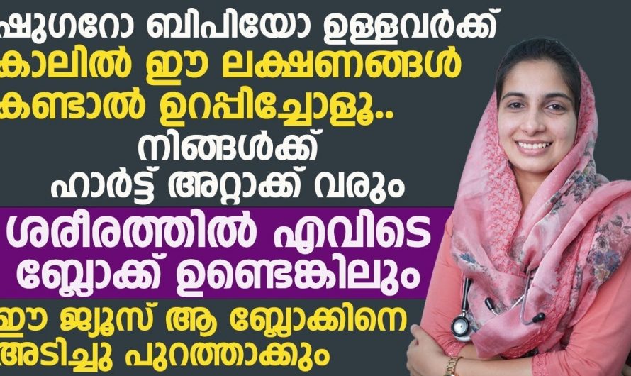 നിങ്ങളുടെ കാലിൽ ഇങ്ങനെ വരുന്നുണ്ട് എങ്കിൽ ശ്രദ്ധിക്കുക അത് ഹാർട്ടറ്റാക്ക് ലക്ഷണങ്ങളാകാം.