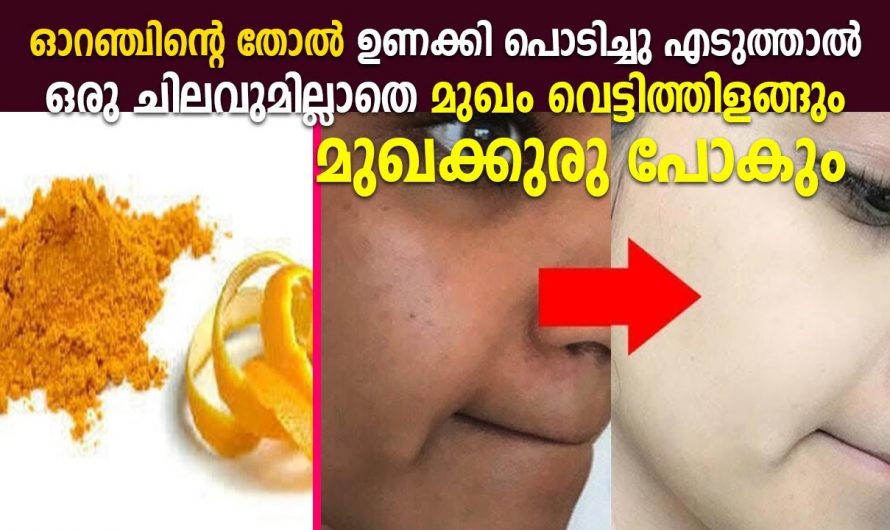 ആരെയും ആകർഷിക്കുന്ന മുഖസൗന്ദര്യം ലഭിക്കാൻ…🥰