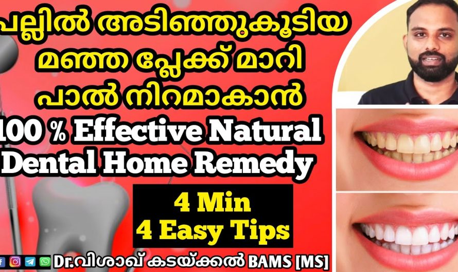 പല്ലുകളിലെ മഞ്ഞനിറവും കറയും പരിഹരിച്ച് തിളക്കവും ഭംഗിയും നൽകാൻ…👌