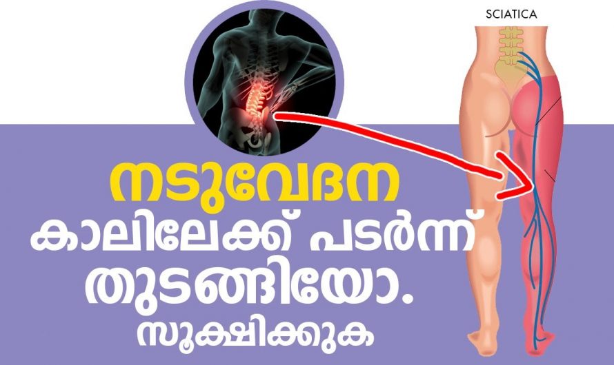 നടുവിൽ തുടങ്ങി കാലിലേക്ക് പടരുന്ന വേദന എന്തുകൊണ്ടാണ്..😱