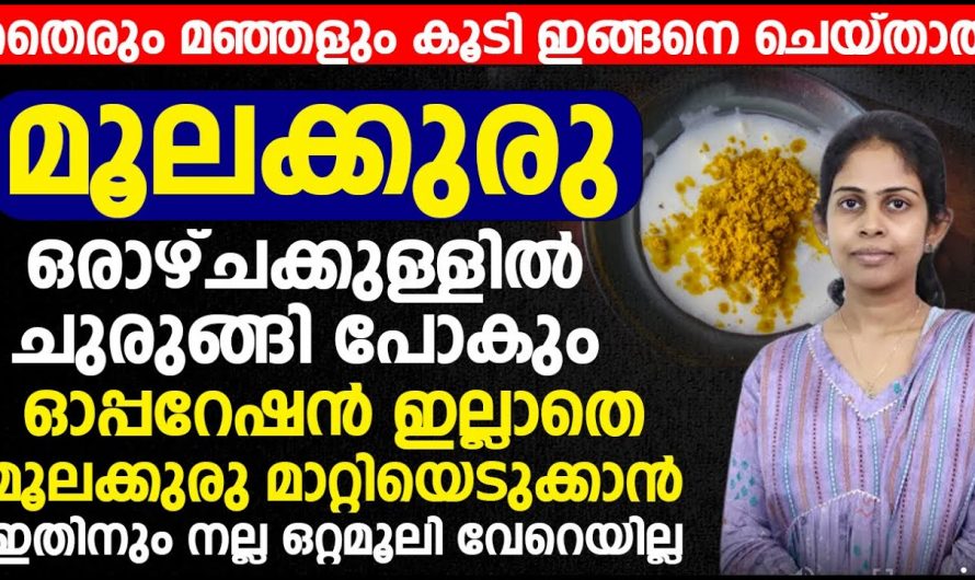 ഓപ്പറേഷൻ ഇല്ലാതെ മൂലക്കുരു എളുപ്പത്തിൽ ഇല്ലാതാക്കാം…😱