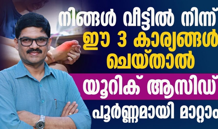മൈഗ്രേൻ വരാതിരിക്കാൻ ഇത്തരം കാര്യങ്ങൾ ശ്രദ്ധിക്കുക…😱