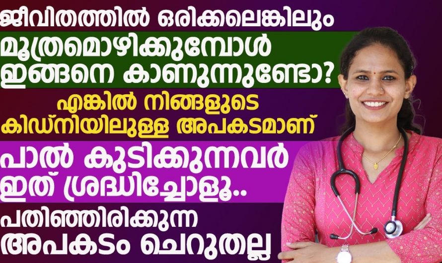 കിഡ്നി സ്റ്റോൺ പരിഹരിക്കുന്നതിനുള്ള മാർഗങ്ങൾ..😱