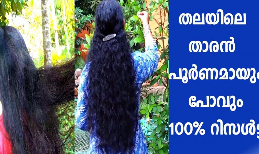 കരുത്തുള്ള മുടി താരനില്ലാതെ വളരുവാൻ