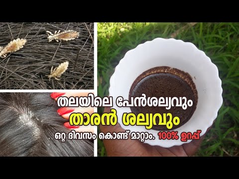 പേൻ ശല്യവും താരനും  ഒറ്റ ദിവസം കൊണ്ട് മാറ്റാം 🤔