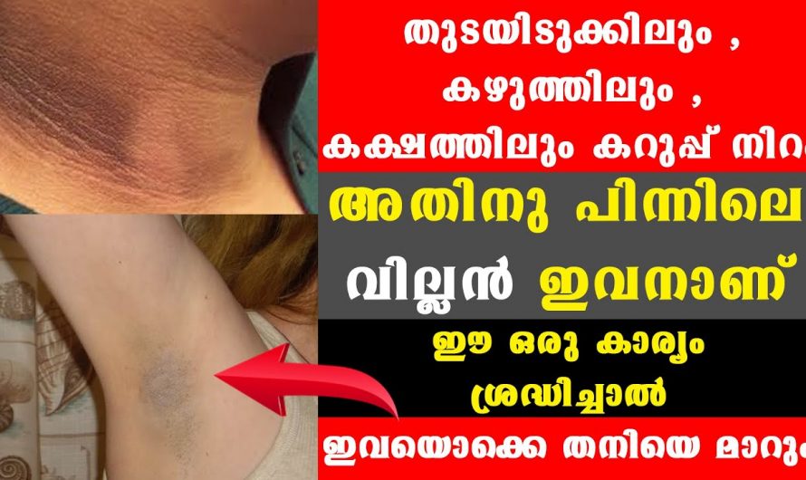 വളരെ എളുപ്പത്തിൽ തന്നെ കക്ഷത്തിലും തുടയിടുക്കിലും ഉള്ള കറുപ്പുനിറം മാറ്റിയെടുക്കാം.😄