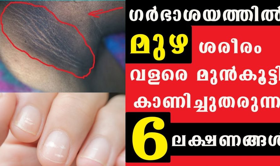 ഗർഭാശയം മുഴകൾ ഉണ്ടാകുന്നതിന്റെ ലക്ഷണങ്ങളും കാരണങ്ങളും…😱
