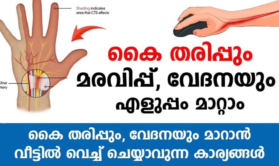 കൈകളിലെ തരിപ്പും, മരവിപ്പ്,  വേദനയും എങ്ങനെ കുറയ്ക്കാം. 😱