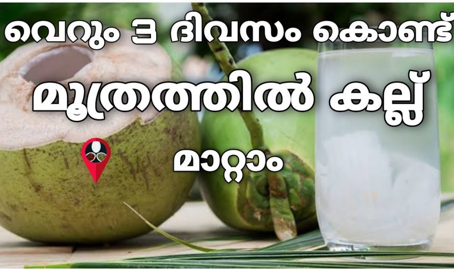 മൂത്രത്തിൽ കല്ല് എളുപ്പത്തിൽ പരിഹരിക്കും..😱