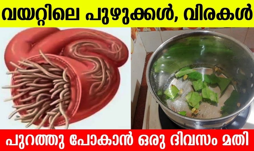 വിരശല്യം  പൂർണമായും ഇല്ലാതാക്കാൻ….👌