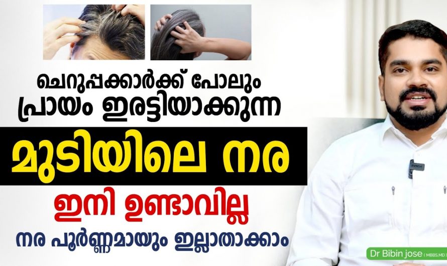 മുടിയുടെ നര പൂർണ്ണമായും ഇല്ലാതാക്കാം അതോടൊപ്പം തന്നെ താരനും.🥰
