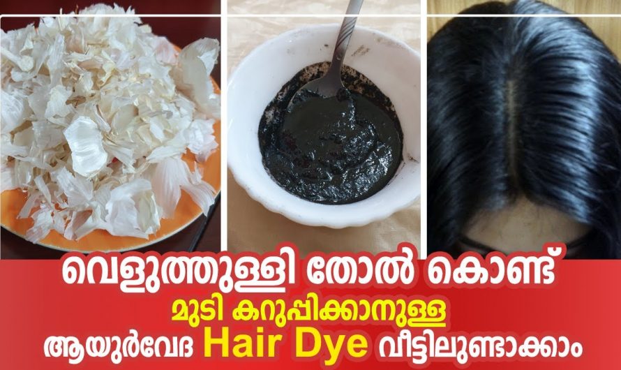 വെളുത്തുള്ളി തോൽ ഉണ്ടോ എങ്കിൽ മുടിയിലെ നര പരിഹരിക്കാം…👌