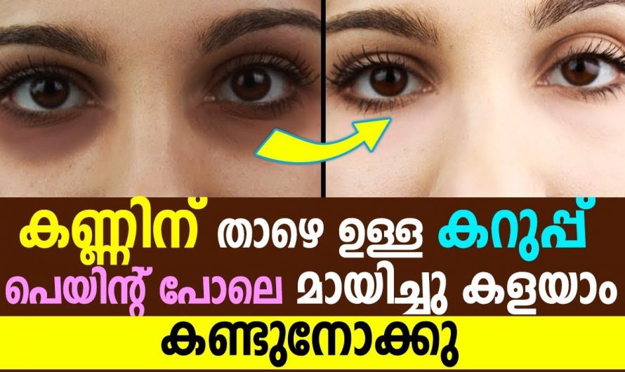 കണ്ണിനു ചുറ്റുമുള്ള കറുപ്പുനിറംനിമിഷ നേരം കൊണ്ട് അപ്രത്യക്ഷമാകാൻ.