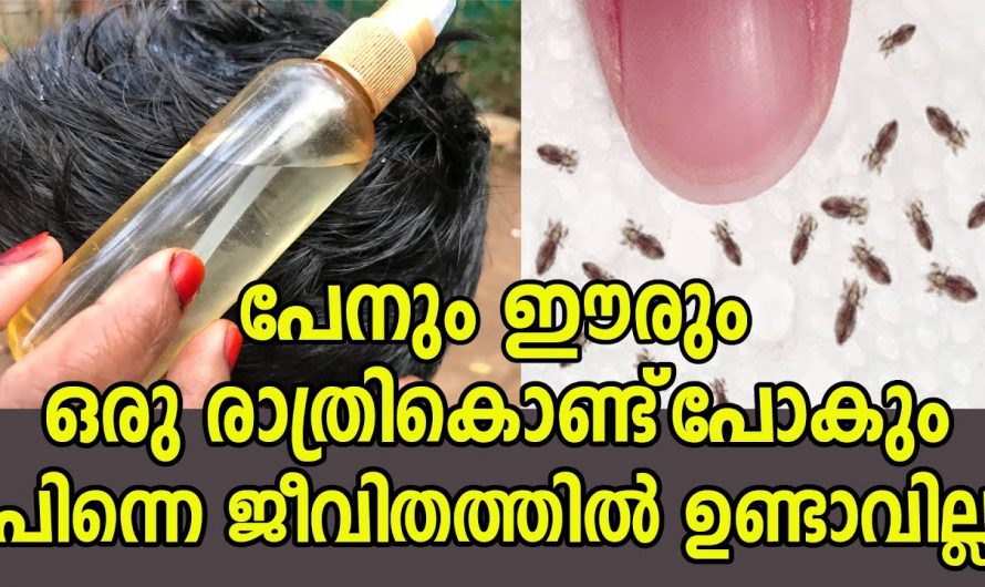 തലമുടിയിലെ ഈരും പേനും ഒഴിവാക്കി കുട്ടികളുടെ ആത്മവിശ്വാസം വർധിപ്പിക്കാൻ ….