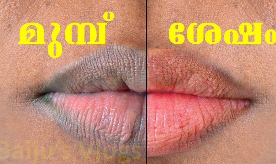 ചുണ്ടുകളിലെ കറുപ്പുനിറവും കറയും എളുപ്പത്തിൽ പരിഹരിക്കാൻ.