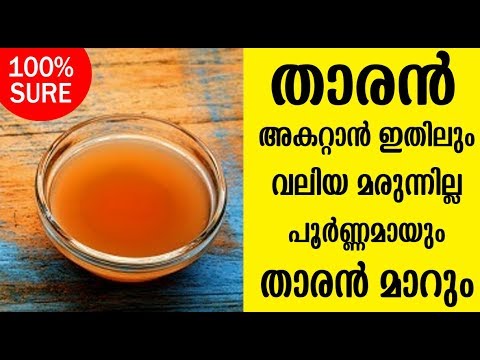 തലമുടിയിലെ താരൻ പരിഹരിക്കുന്ന ഇതാ പ്രകൃതിദത്ത മാർഗ്ഗം..